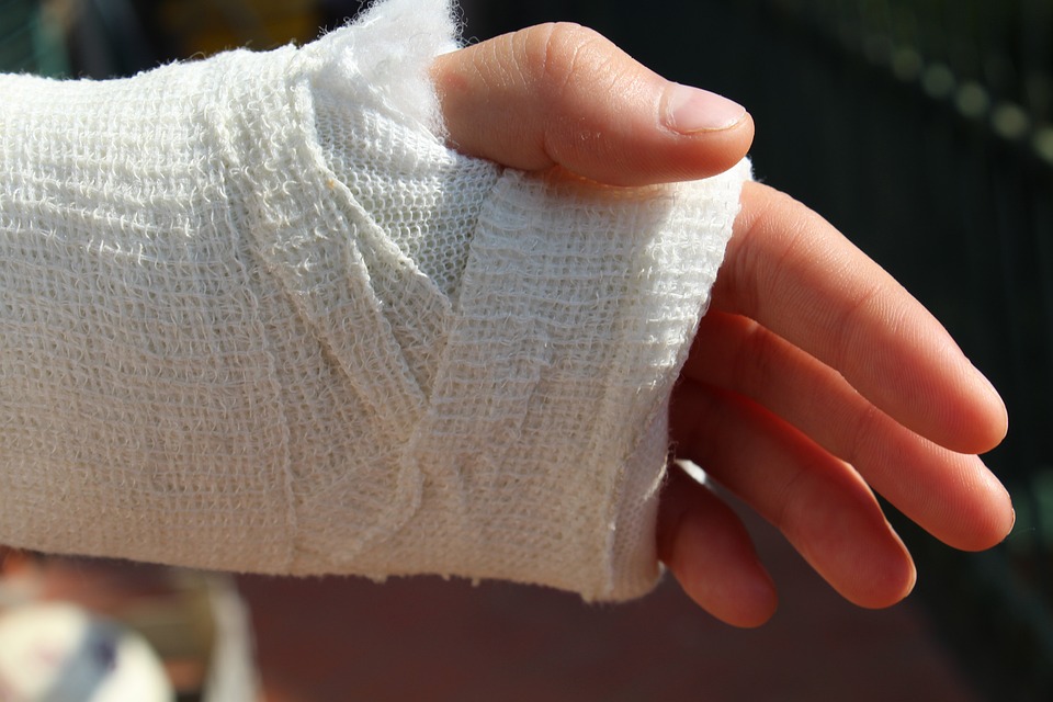A hand in a plaster cast, indicating a broken wrist.