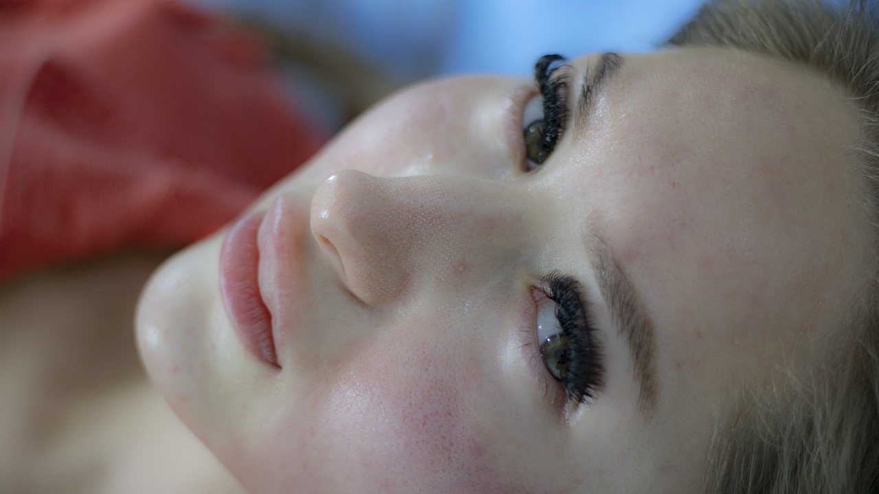 Red, inflamed skin after laser hair removal treatment.