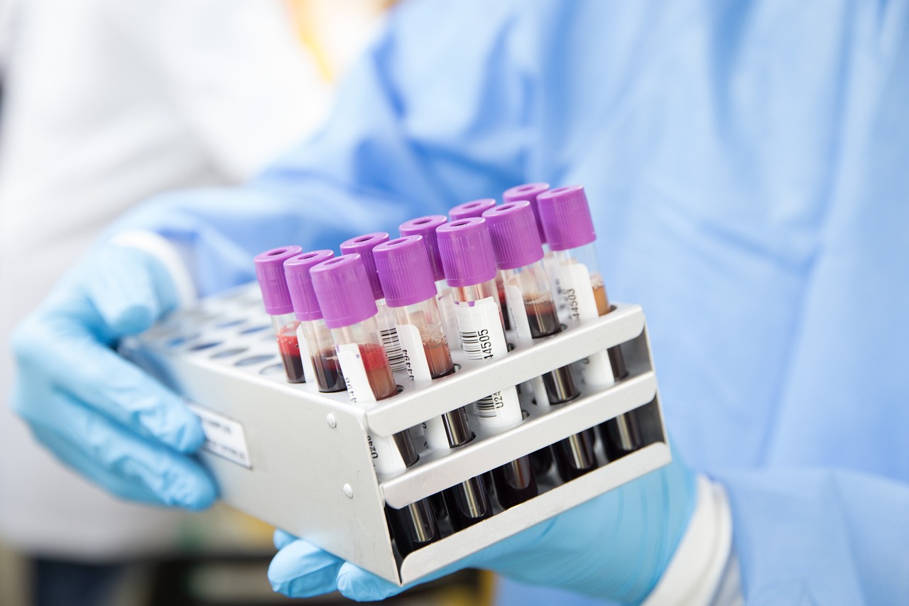 Vials for drug testing, containing samples for analysis