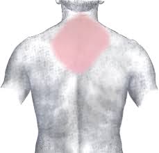 Back Injuries